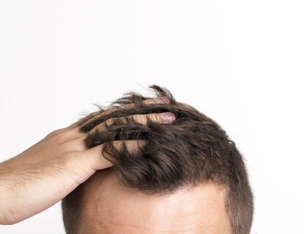 Productos Para Crecimiento De Cabello - The Red Vitamin MX - {{ shop.shopifyCountryName }}