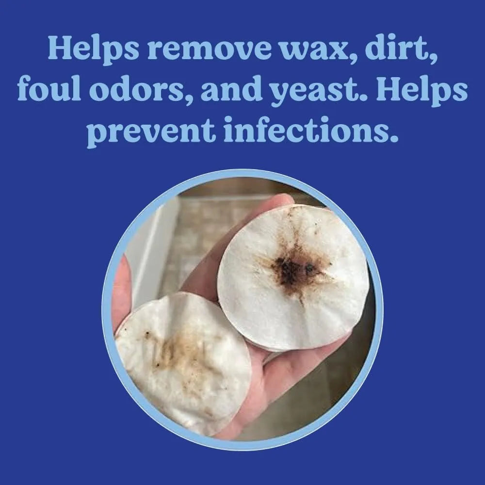 ANGELS' EYES - ANGELS' EYES Ear Cleansing Wipes for Dogs & Cats 100 Toallitas - The Red Vitamin MX - Cuidado Del Oído De Perros - {{ shop.shopifyCountryName }}