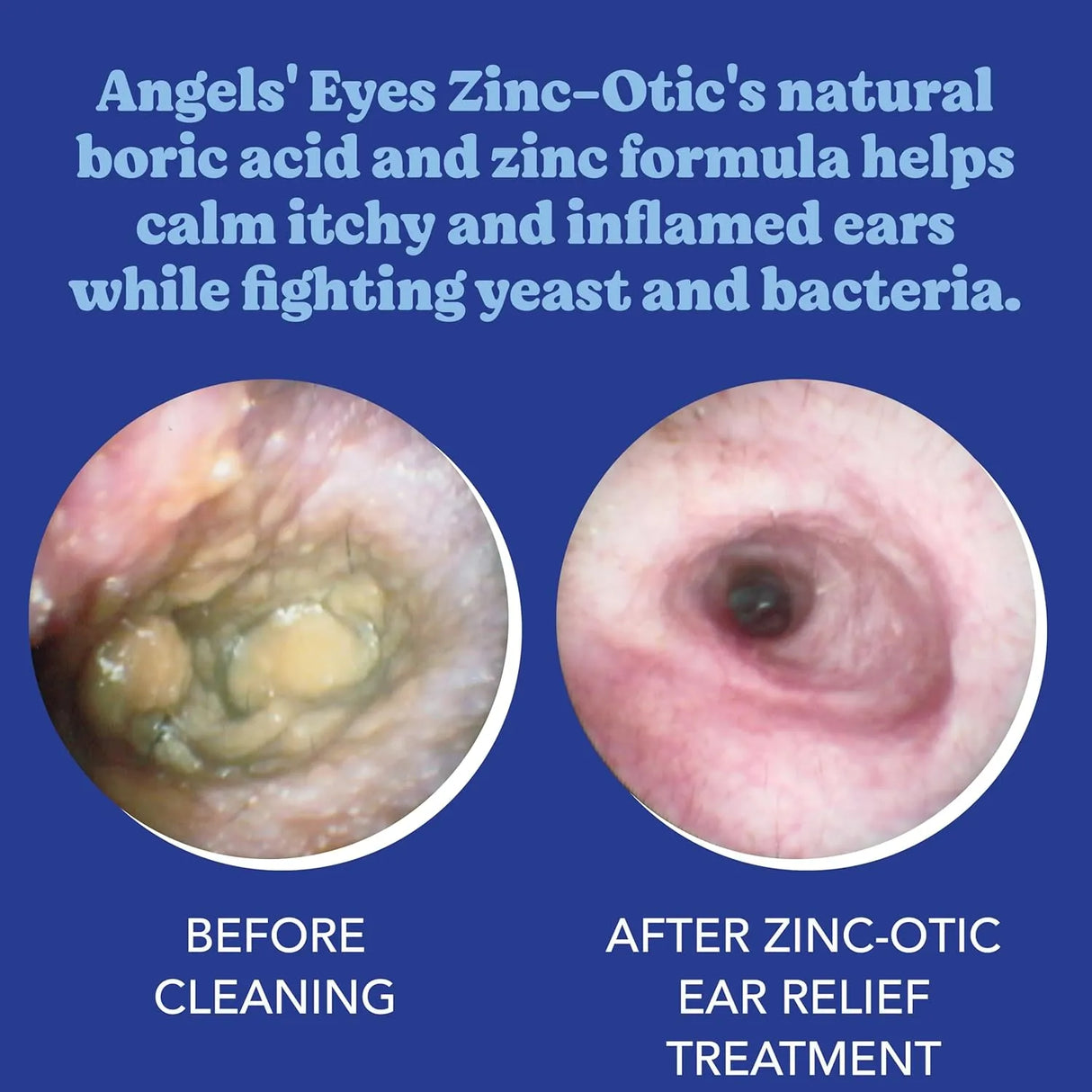 ANGELS’ EYES - ANGELS’ EYES Zinc-Otic Ear Relief Treatment for Dogs and Cats 1 Fl.Oz. - The Red Vitamin MX - Cuidado Del Oído De Perros - {{ shop.shopifyCountryName }}