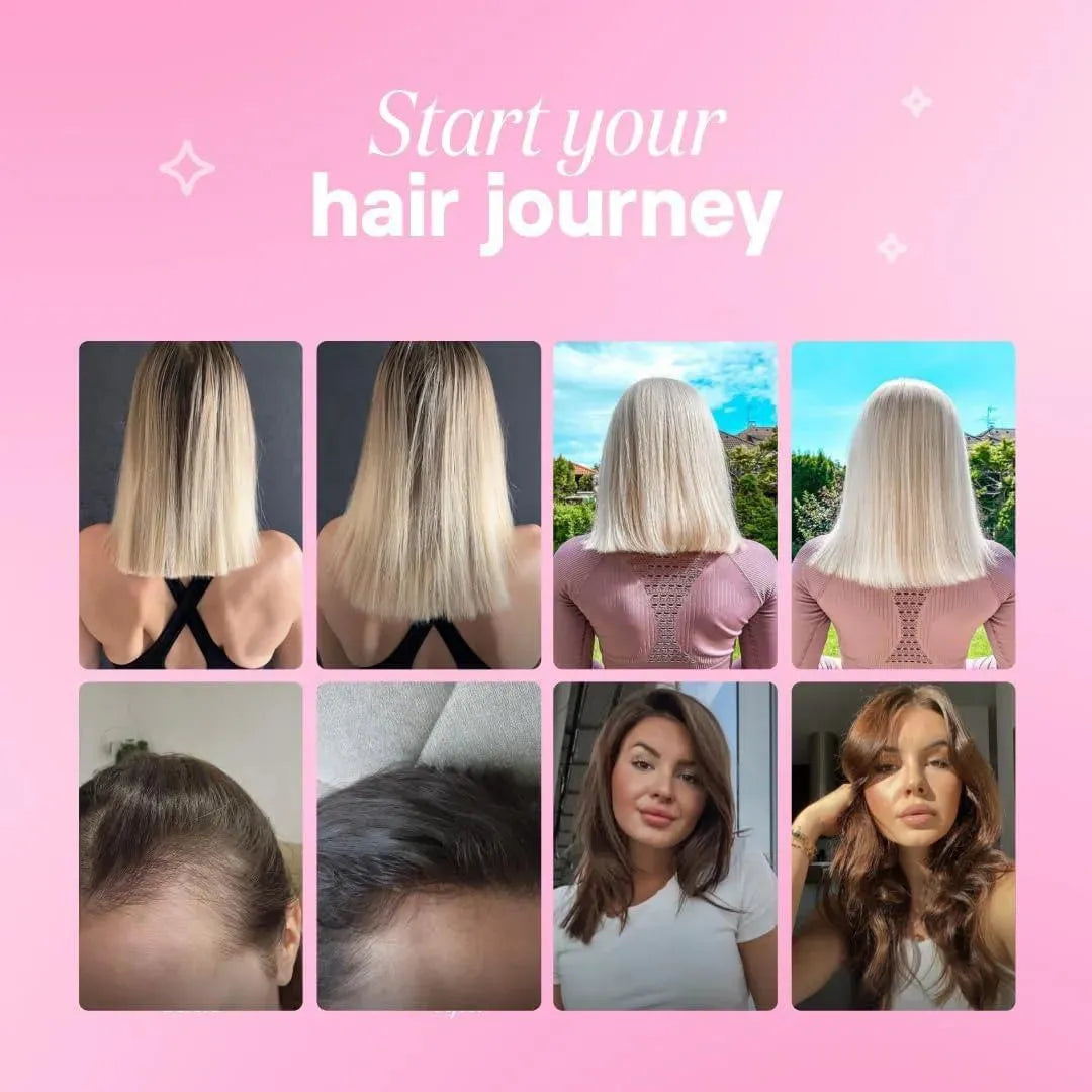 BLOOM HAIR - Bloom Hair Healthy Hair Gummies 60 Gomitas - The Red Vitamin MX - Suplementos Alimenticios - {{ shop.shopifyCountryName }}