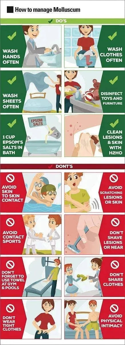 CONZEROL - Conzerol Soap 1 Jabón - The Red Vitamin MX - Tratamiento Molusco Contagioso - {{ shop.shopifyCountryName }}