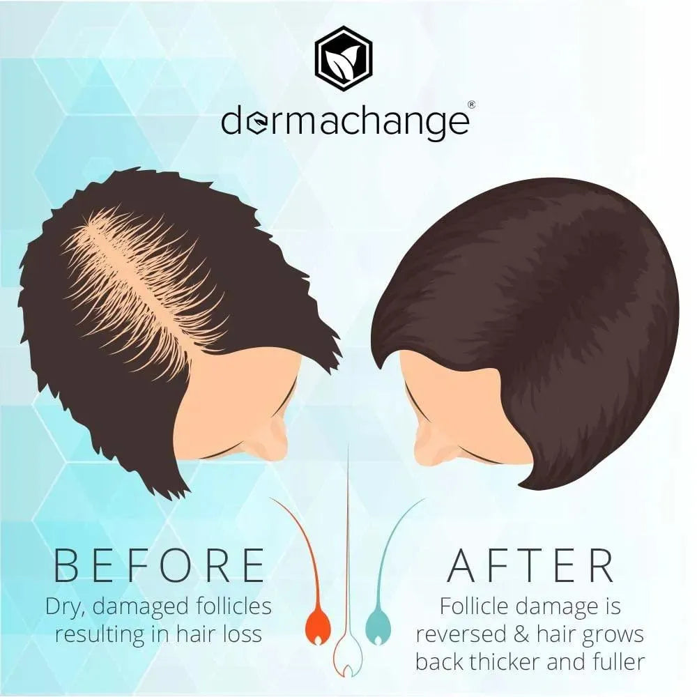 DERMACHANGE - DermaChange Hair Growth Shampoo for Thining Hair and Hair Loss 236Ml. - The Red Vitamin MX - Shampoo Para Cabello - {{ shop.shopifyCountryName }}