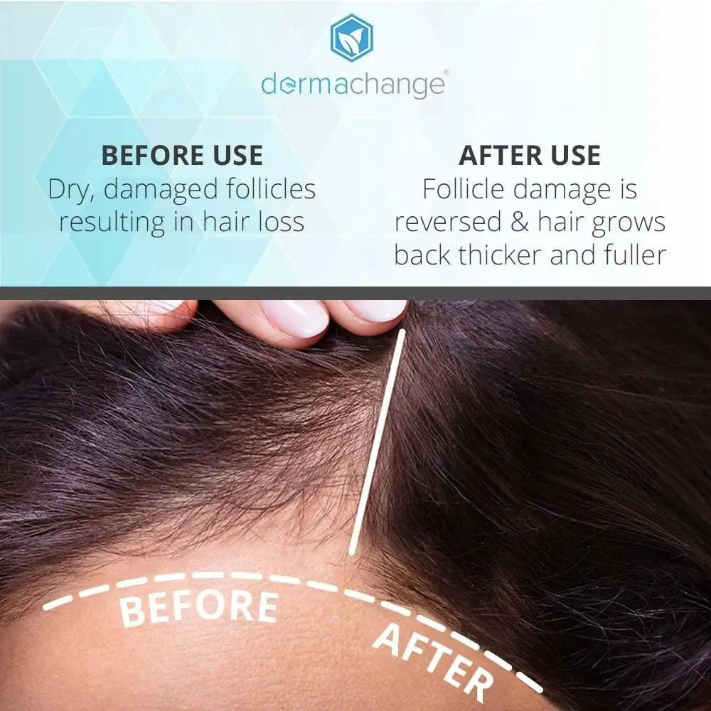 DERMACHANGE - DermaChange Hair Growth Shampoo for Thining Hair and Hair Loss 236Ml. - The Red Vitamin MX - Shampoo Para Cabello - {{ shop.shopifyCountryName }}