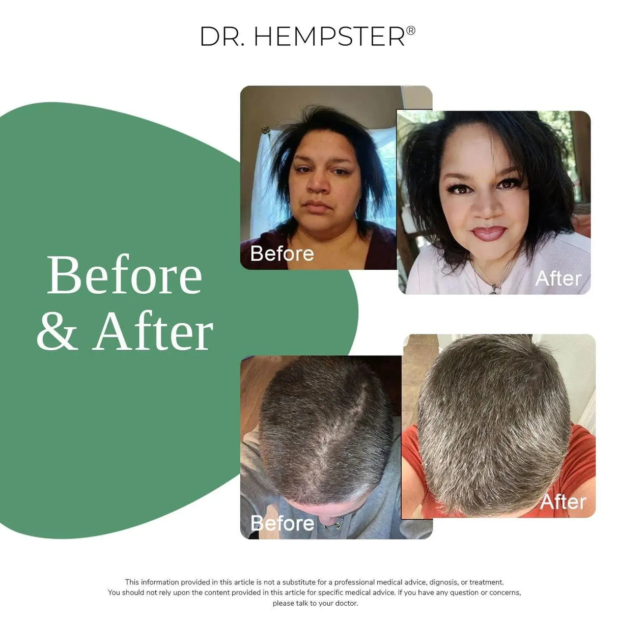 DR. HEMPSTER - DR. HEMPSTER Biotin Hair Loss Shampoo for Men & Women 503Ml. - The Red Vitamin MX - Shampoo Para Cabello - {{ shop.shopifyCountryName }}