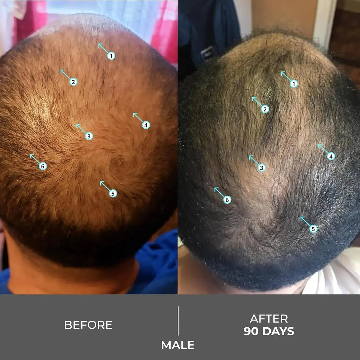 DS LABORATORIES - DS Laboratories Revita Extra Strength Shampoo 205Ml. - The Red Vitamin MX - Shampoo Para Cabello - {{ shop.shopifyCountryName }}