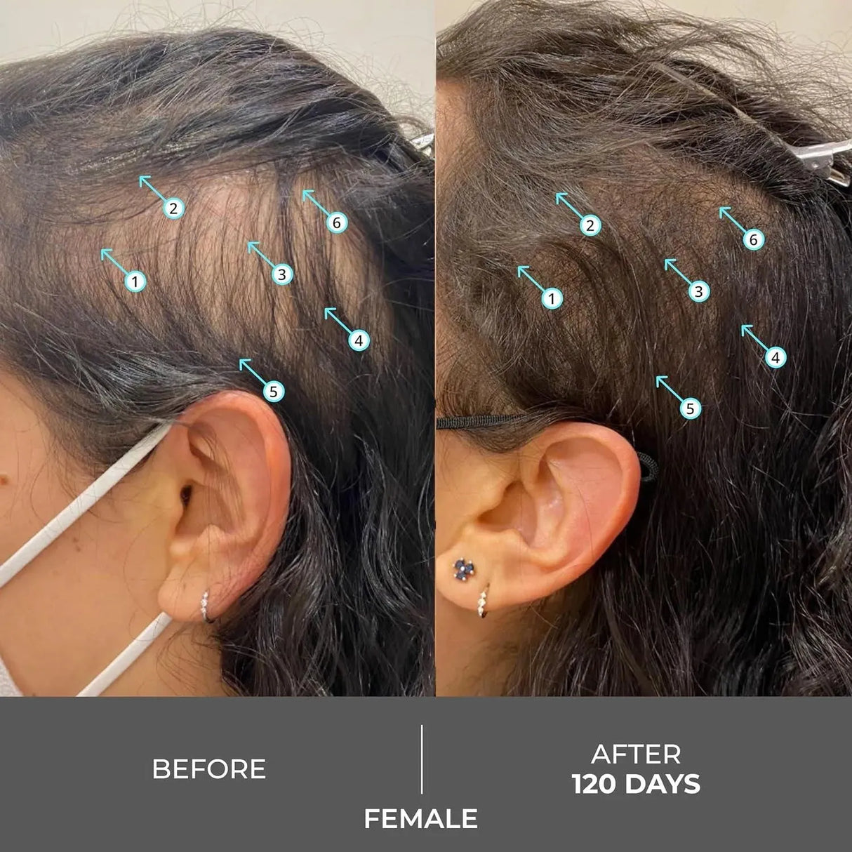 DS LABORATORIES - DS Laboratories Revita Extra Strength Shampoo 205Ml. - The Red Vitamin MX - Shampoo Para Cabello - {{ shop.shopifyCountryName }}