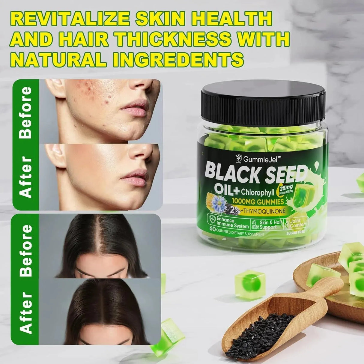 GUMMIEJEL - GummieJel Black Seed Oil Gummies 60 Gomitas - The Red Vitamin MX - Suplementos Alimenticios - {{ shop.shopifyCountryName }}