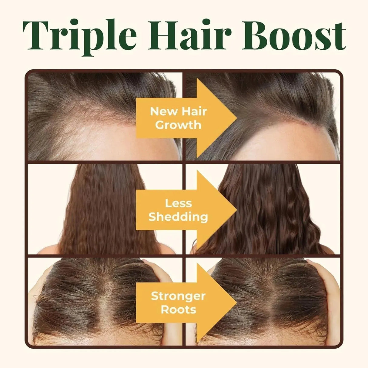 HEEBIN'S - Heebin's Royal Hair, Brows & Lashes 60 Tabletas - The Red Vitamin MX - Suplementos Alimenticios - {{ shop.shopifyCountryName }}