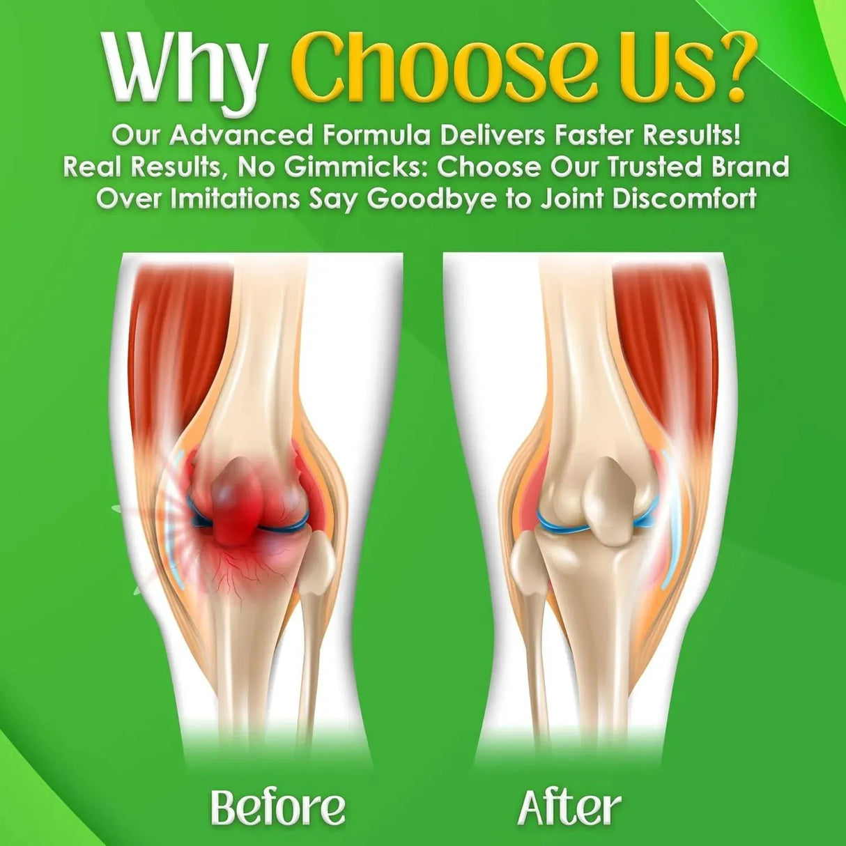 NUTRIGOUT - NutriGout Uric Acid Cleanse 60 Capsulas - The Red Vitamin MX - Suplementos Alimenticios - {{ shop.shopifyCountryName }}