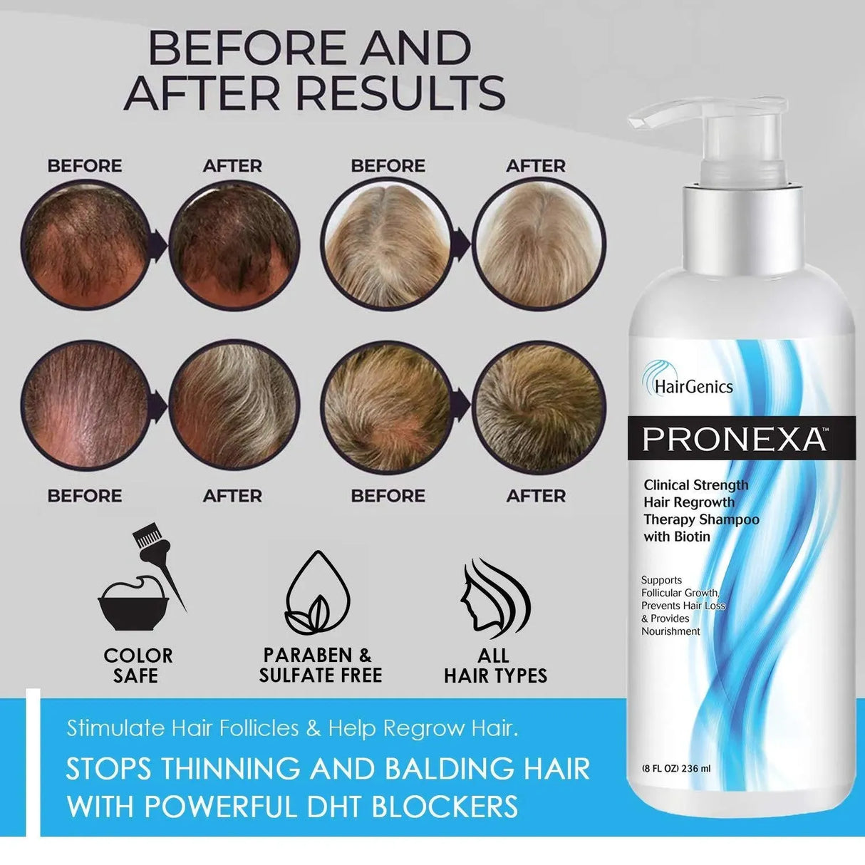 PRONEXA - Pronexa Hairgenics Pronexa Clinical Strength Hair Growth & Regrowth Therapy Hair Loss Shampoo 236Ml. - The Red Vitamin MX - Shampoo Para Cabello - {{ shop.shopifyCountryName }}