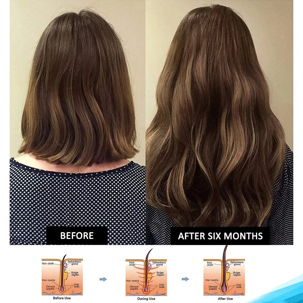 PRONEXA - Pronexa Hairgenics Pronexa Clinical Strength Hair Growth & Regrowth Therapy Hair Loss Shampoo 236Ml. - The Red Vitamin MX - Shampoo Para Cabello - {{ shop.shopifyCountryName }}