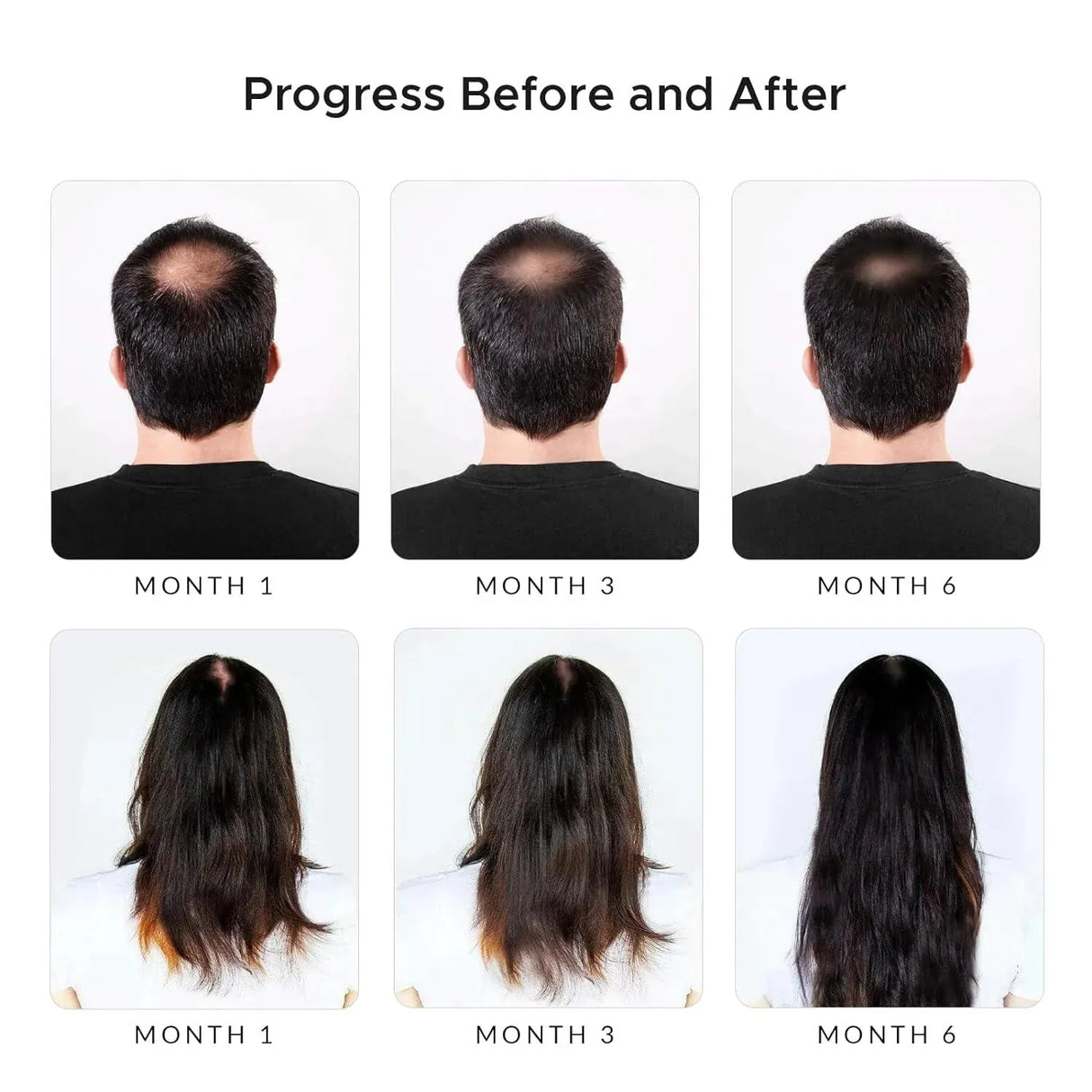 RIVERMINT - Rivermint Premium: Shampoo with Minoxidil, Biotin, DHT Blocker Saw Palmetto & Caffeine 236Ml. - The Red Vitamin MX - Shampoo Para Cabello - {{ shop.shopifyCountryName }}