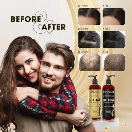 SHINY LEAF - Shiny Leaf DHT Pro Shampoo Advanced Formula with Procapil and Capixyl 473Ml. - The Red Vitamin MX - Shampoo Para Cabello - {{ shop.shopifyCountryName }}