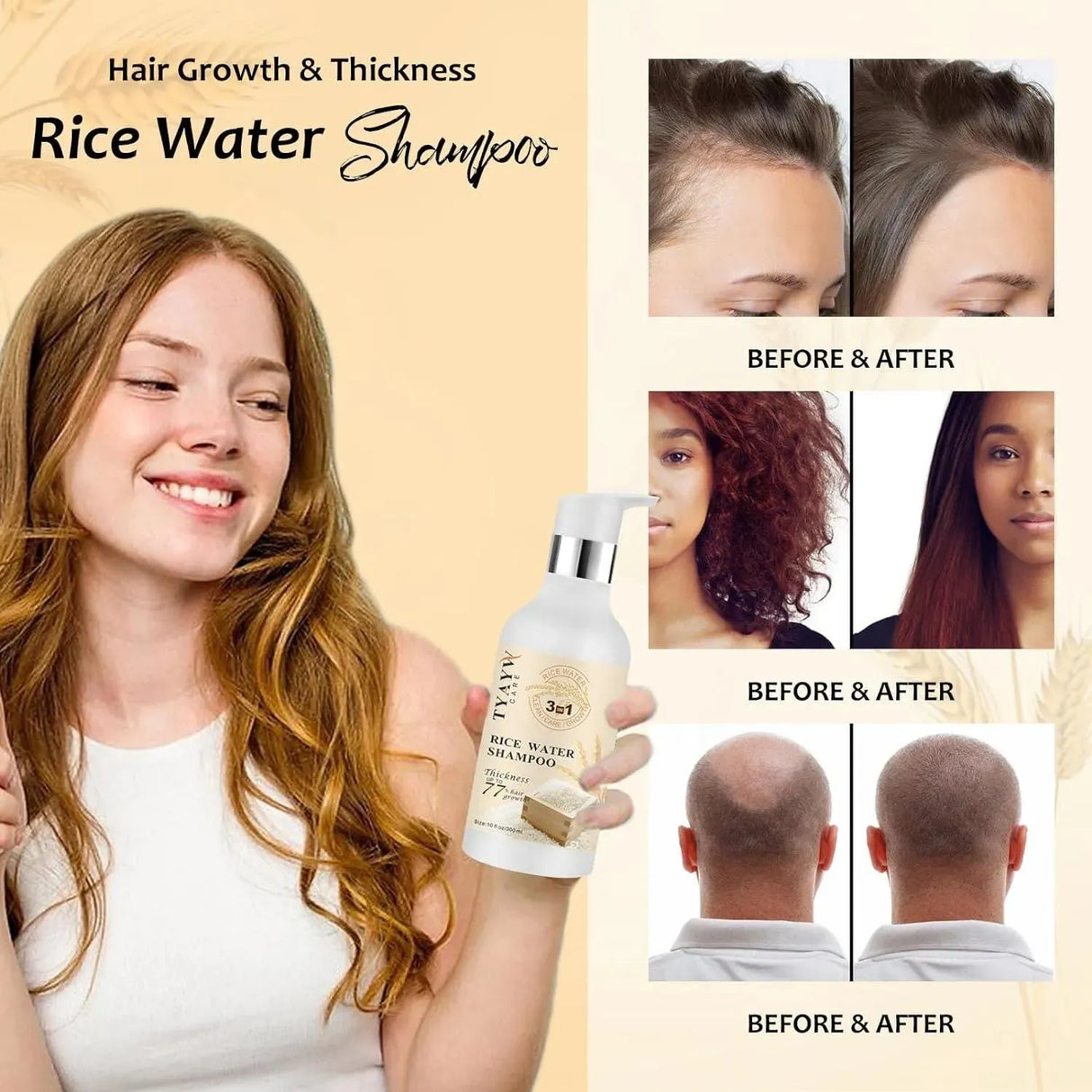 TYAYW - TYAYW Rice Water Hair Growth Shampoo 300Ml. - The Red Vitamin MX - Shampoo Para Cabello - {{ shop.shopifyCountryName }}