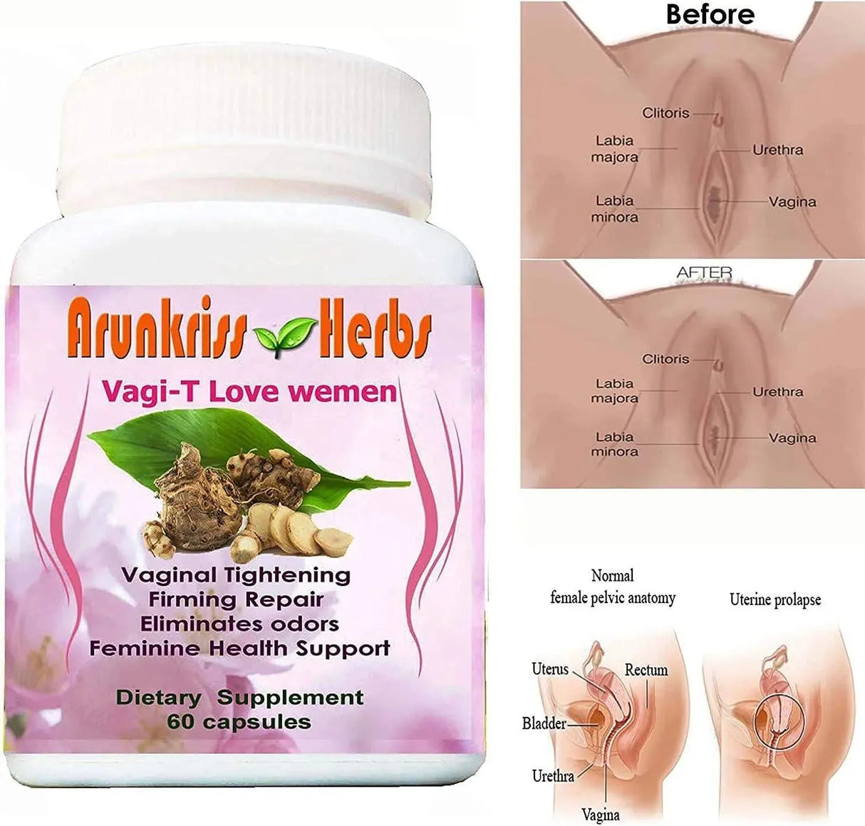 VAGI-T - Vagi-T Love Women Vaginal Tightening Herbal Supplement 60 Capsulas - The Red Vitamin MX - Hidratantes Vaginales - {{ shop.shopifyCountryName }}