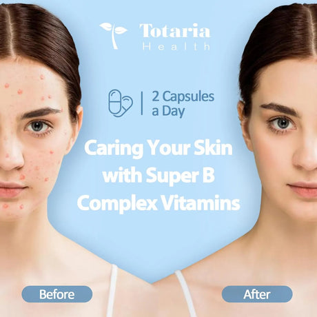 TOTARIA - Totaria 13-in-1 Vitamin B Complex Plus 120 Capsulas - The Red Vitamin MX - Suplementos Alimenticios - {{ shop.shopifyCountryName }}