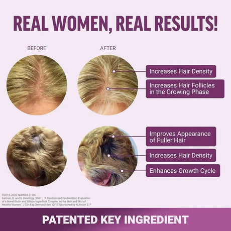 FORCE FACTOR - FORCE FACTOR Hair Growth Accelerator 60 Capsulas - The Red Vitamin MX - Suplementos Alimenticios - {{ shop.shopifyCountryName }}