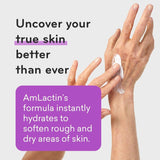 AMLACTIN - AmLactin Ultra Smoothing Body & Hand Cream 140Gr. - The Red Vitamin MX - Cremas Corporales - {{ shop.shopifyCountryName }}