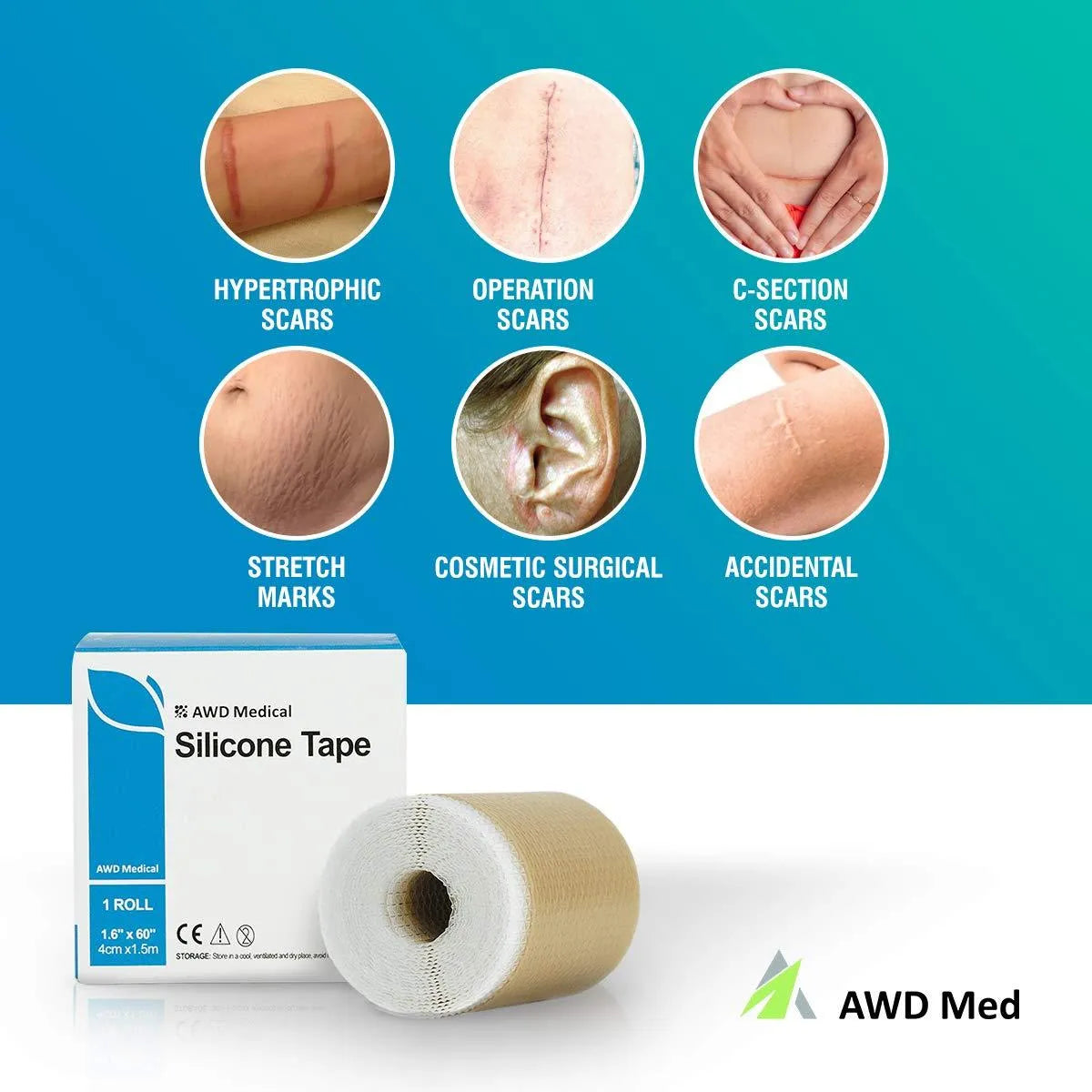 AWD MEDICAL - AWD Medical Silicone Tape Scar Sheets 1 Rollo 1.6” x 60” - The Red Vitamin MX - Lámina De Gel De Silicona - {{ shop.shopifyCountryName }}