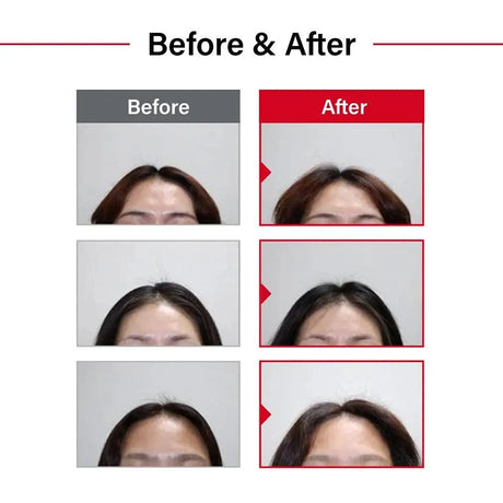 DR.FORHAIR - DR.FORHAIR Folligen Shampoo 500Ml. - The Red Vitamin MX - Shampoo Para Cabello - {{ shop.shopifyCountryName }}