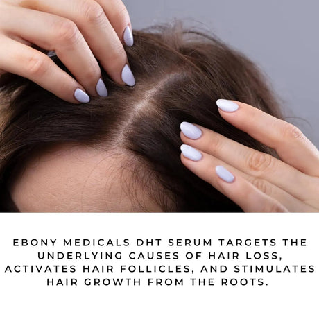 EBONY MEDICAL - Ebony Medicals DHT Blocker Hair Growth Serum 2 Fl.Oz. - The Red Vitamin MX - Suplementos Alimenticios - {{ shop.shopifyCountryName }}