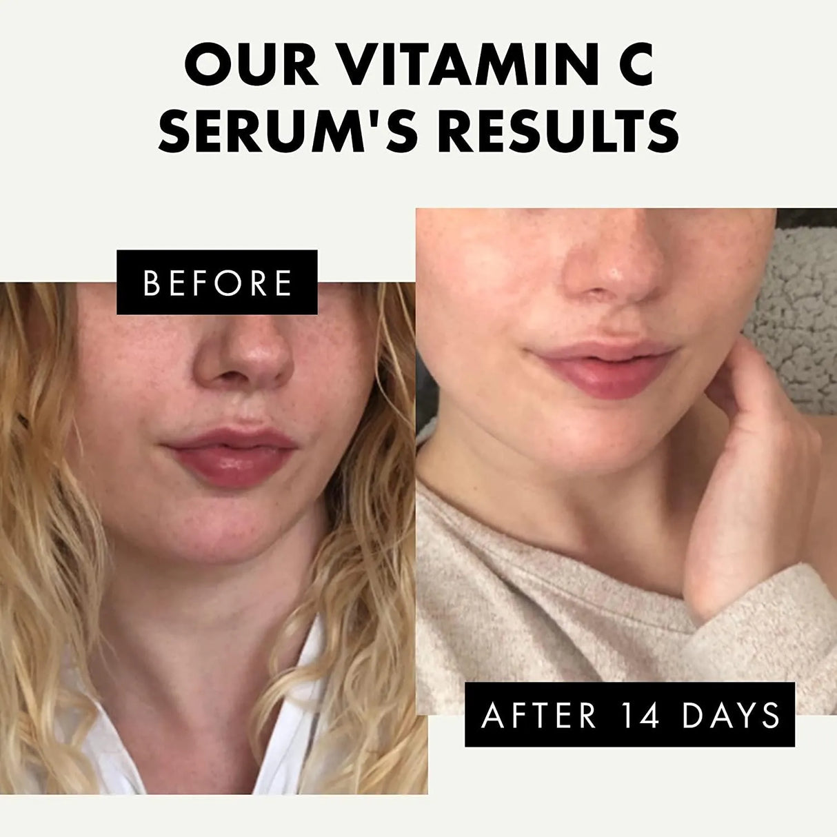 ECLAT SKINCARE - PURE Vitamin C Serum for Face 20% Vitamin C Facial Serums 30Ml. - The Red Vitamin MX - Sueros Para La Cara - {{ shop.shopifyCountryName }}