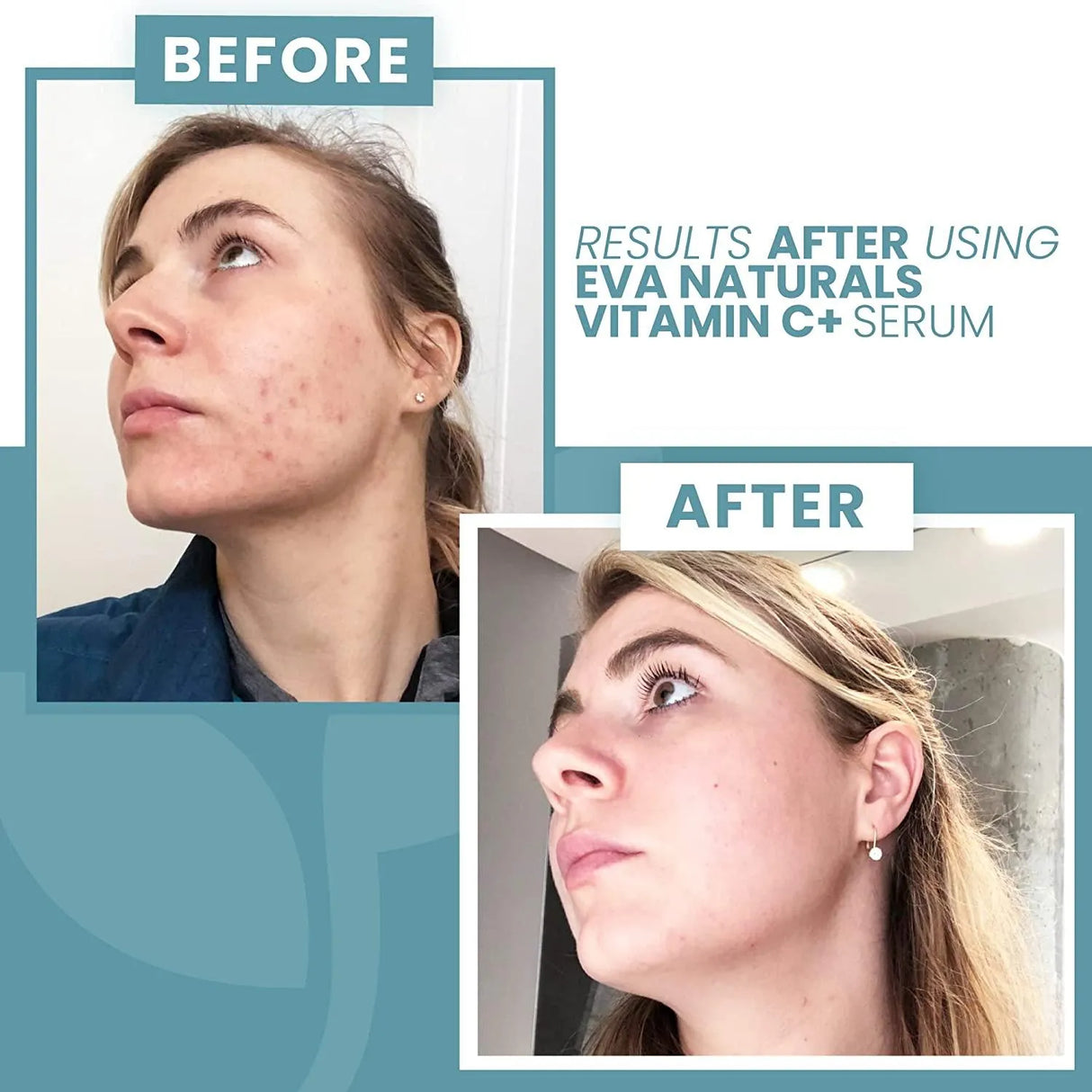 EVA NATURALS - Eva Naturals Vitamin C Serum for Face Anti Aging Serum - The Red Vitamin MX - Sueros Para La Cara - {{ shop.shopifyCountryName }}