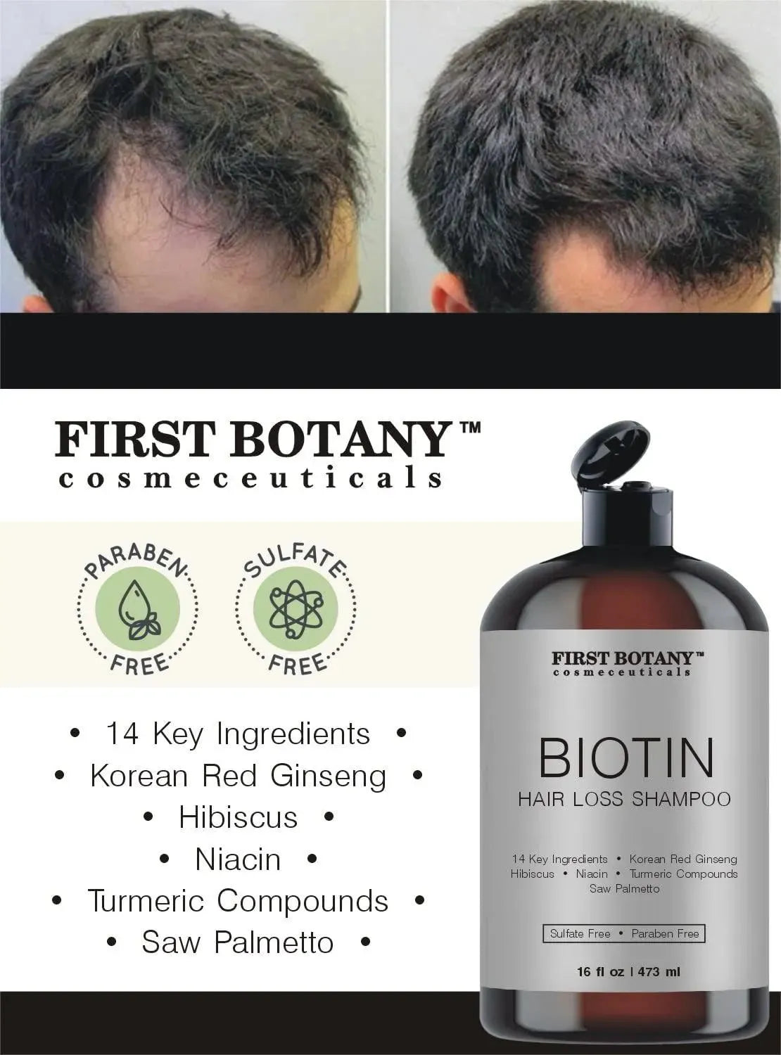 FIRST BOTANY - First Botany Cosmeceuticals Hair Regrowth and Anti Hair Loss Shampoo 473Ml. - The Red Vitamin MX - Shampoo Para Cabello - {{ shop.shopifyCountryName }}