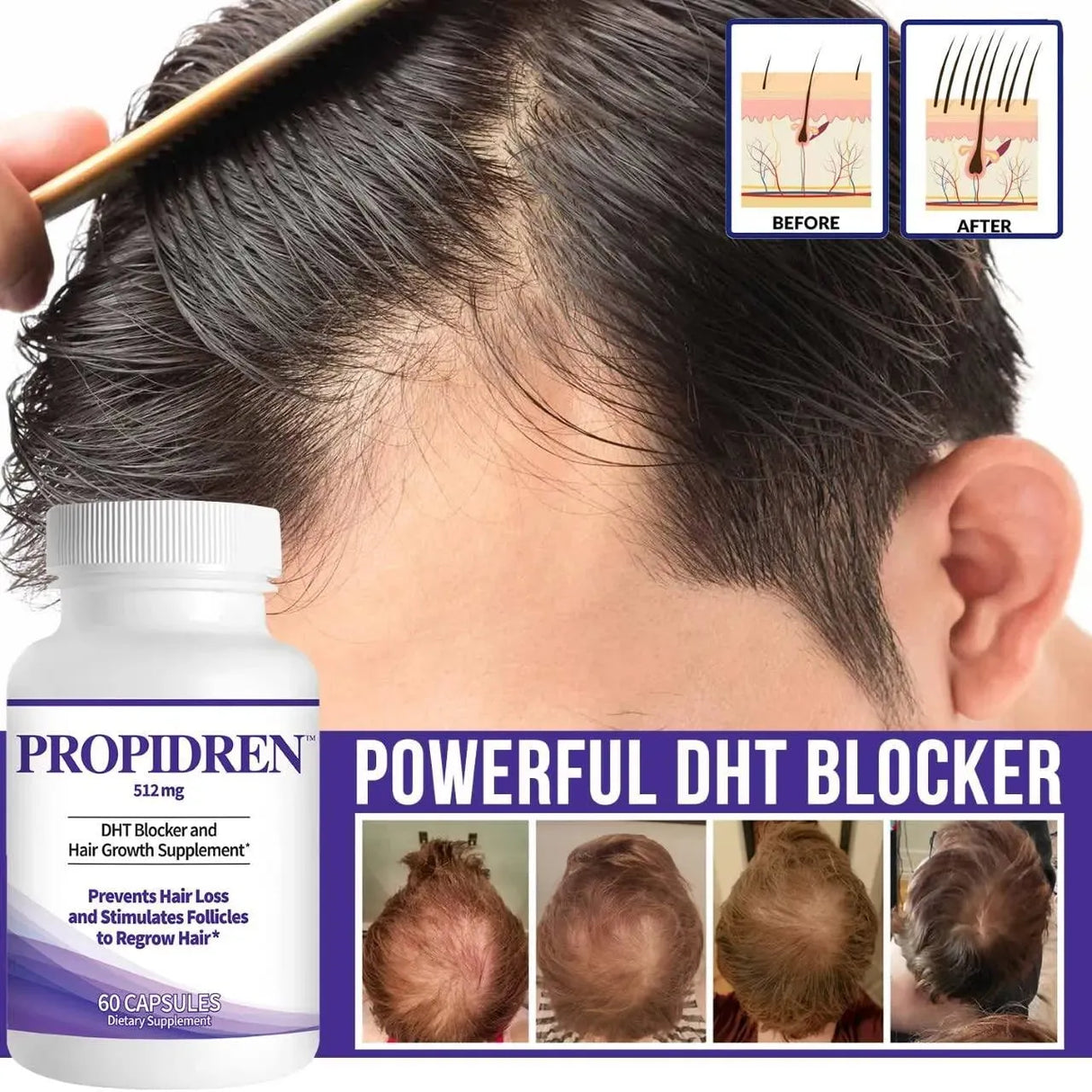 HAIRGENICS - Propidren by HairGenics DHT Blocker & Hair Growth 60 Capsulas - The Red Vitamin MX - Suplementos Alimenticios - {{ shop.shopifyCountryName }}