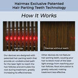 HAIRMAX - HairMax ULTIMA 12 LaserComb - The Red Vitamin MX - Dispositivos Para El Crecimiento Del Cabello - {{ shop.shopifyCountryName }}