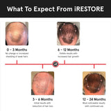 IRESTORE - iRestore Essential Laser Hair Growth System - The Red Vitamin MX - Dispositivos Para El Crecimiento Del Cabello - {{ shop.shopifyCountryName }}