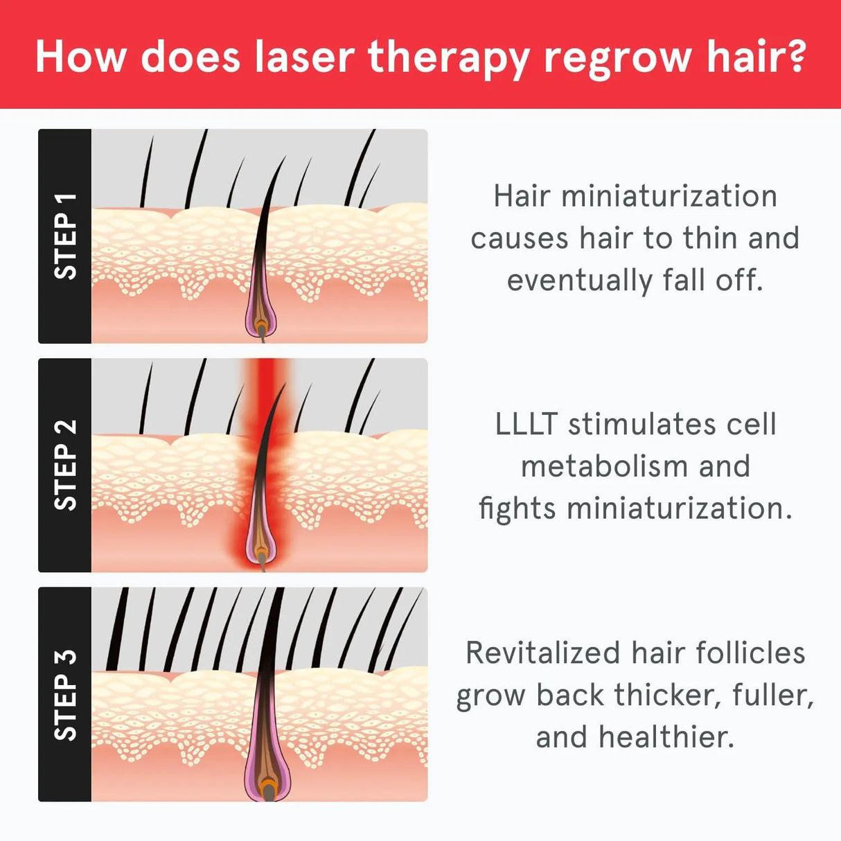 IRESTORE - iRestore Essential Laser Hair Growth System - The Red Vitamin MX - Dispositivos Para El Crecimiento Del Cabello - {{ shop.shopifyCountryName }}