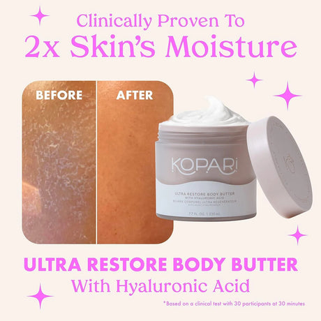 KOPARI - Kopari Ultra Restore Body Butter with Hyaluronic Acid and Vitamin B5 230Ml. - The Red Vitamin MX - Cremas Corporales - {{ shop.shopifyCountryName }}