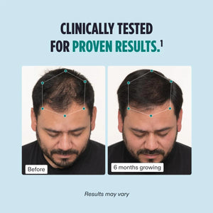 NUTRAFOL - Nutrafol Men's Hair Growth 120 Capsulas - The Red Vitamin MX - Suplementos Alimenticios - {{ shop.shopifyCountryName }}