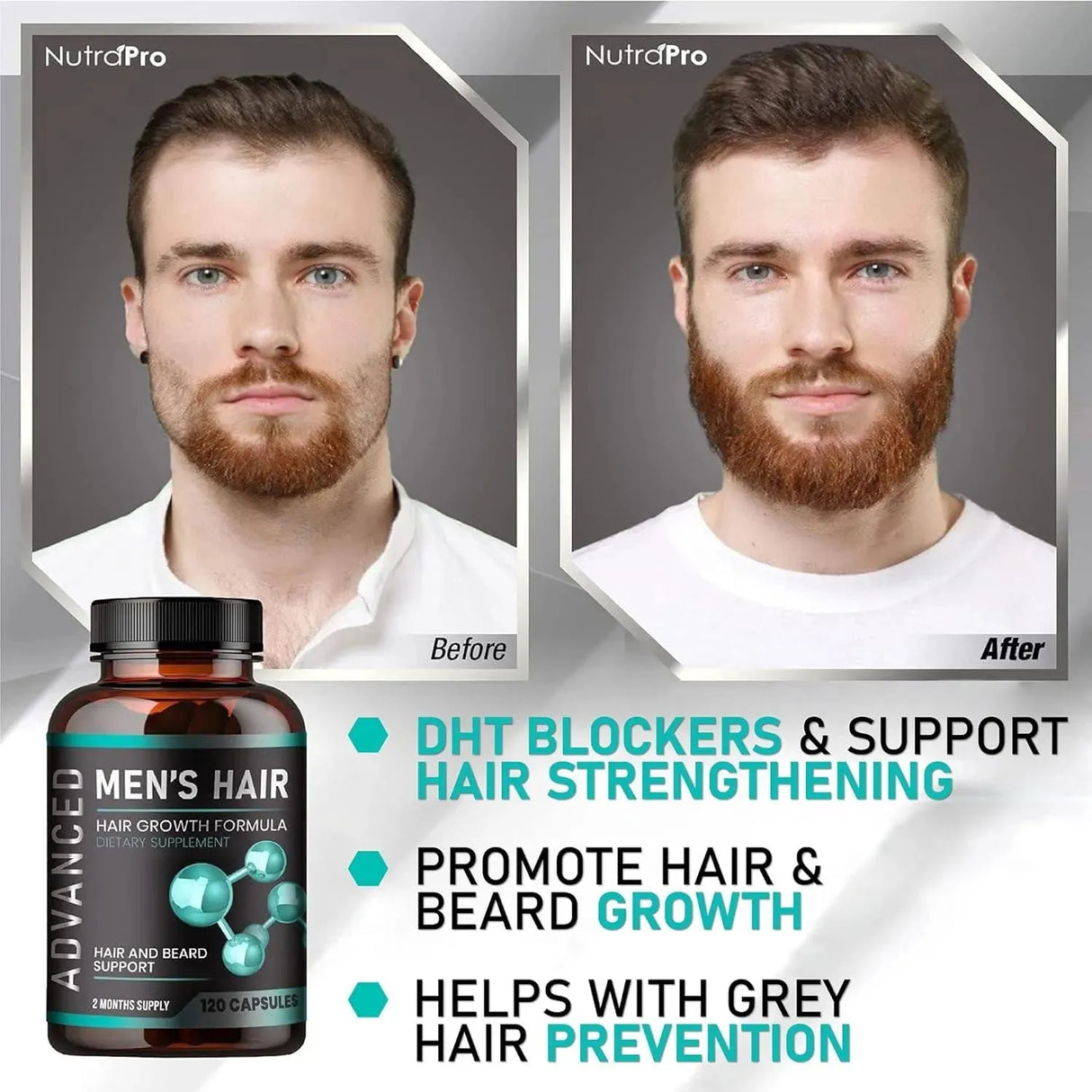 NUTRAPRO - NutraPro Hair Growth Vitamins For Men 120 Capsulas - The Red Vitamin MX - Suplementos Alimenticios - {{ shop.shopifyCountryName }}