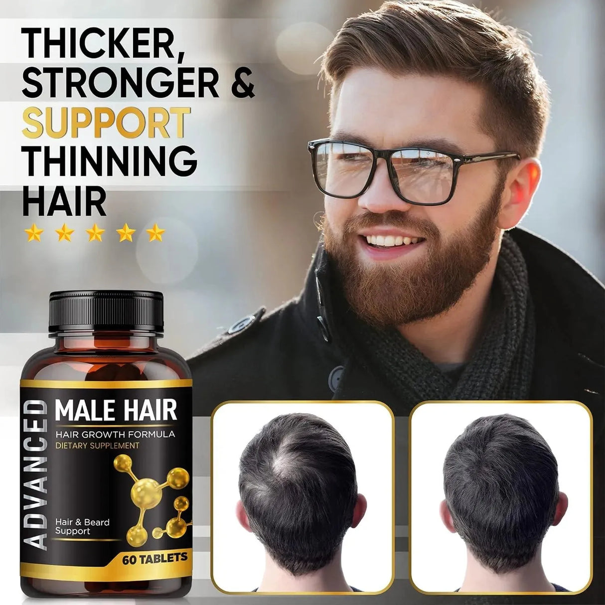 NUTRAPRO - NutraPro Hair Growth Vitamins For Men-Anti Hair Loss Support & Dht Blocker 60 Tabletas - The Red Vitamin MX - Suplementos Alimenticios - {{ shop.shopifyCountryName }}