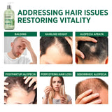 SVVIMER - Rosemary Hair Growth Shampoo 350Ml. - The Red Vitamin MX - Shampoo Para Cabello - {{ shop.shopifyCountryName }}